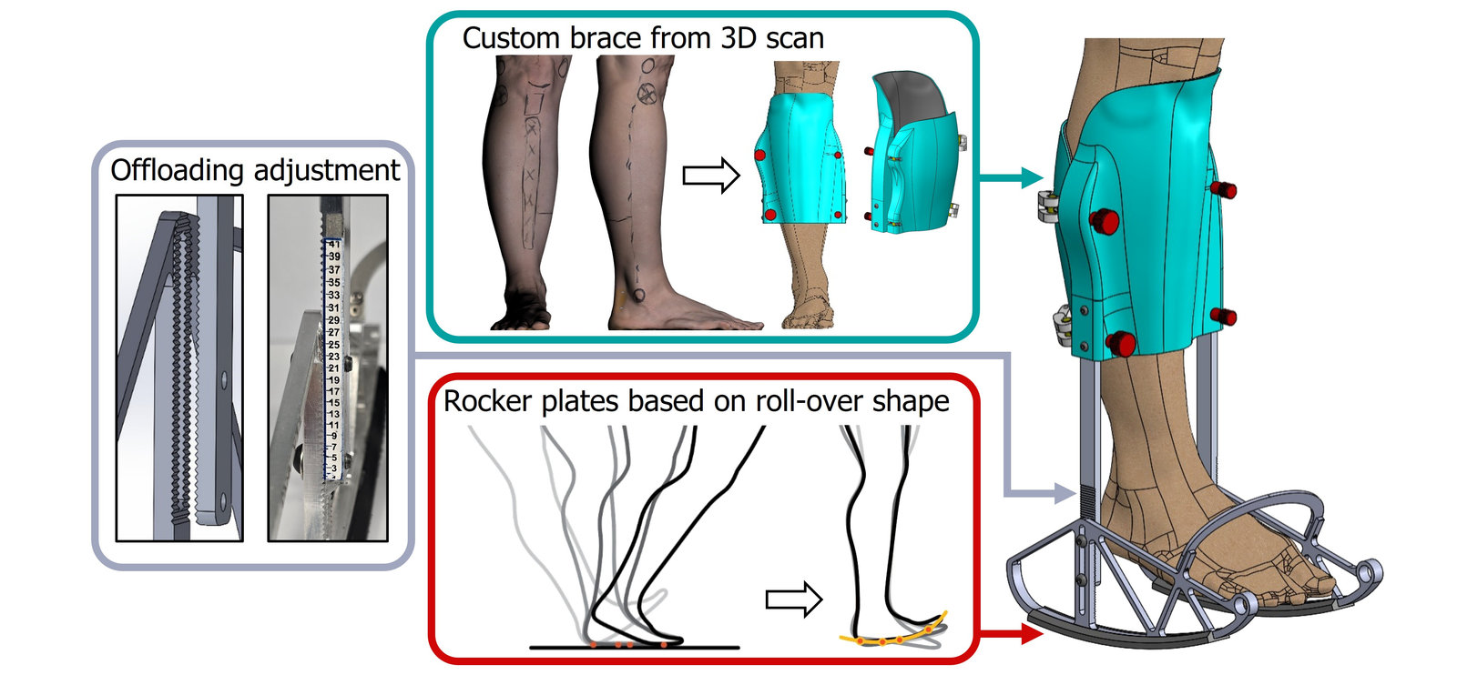 New orthosis for ankle-foot offloading