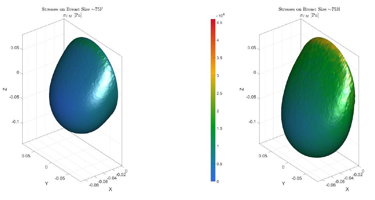 FEA stress distribution in the breast